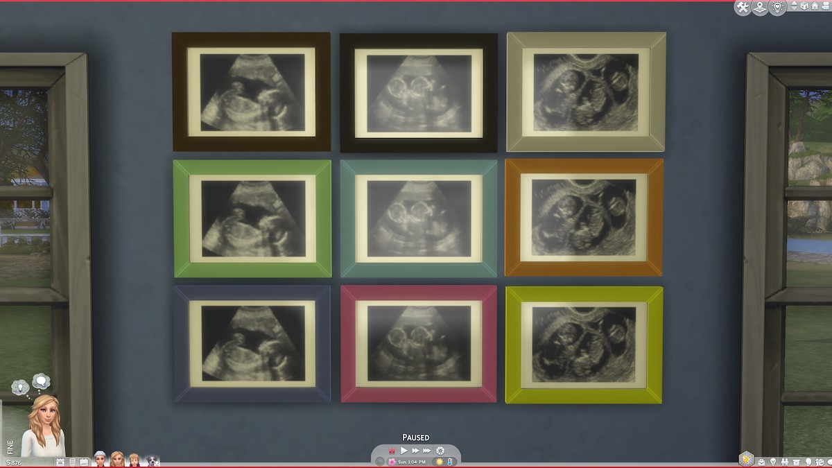 Sims 4 Ultrasound Scans